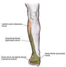 Anatomy, anterior compartment of the leAnatomy, common peroneal nerve injury, deep peroneal nerve, evert the foot, fibular nerve injury, first and second digits of the foot, foot drop, fracture of the neck of the fibula, lateral compartment of the leg, loss of sensation, majority of the dorsum of the foot, most commonly injured nerve in the leg, motor deficits, neck of the fibula, popliteal fossa, proximal fibula fracture, sciatic nerve branches, superficial peroneal nerve, superficial peroneal nerveg